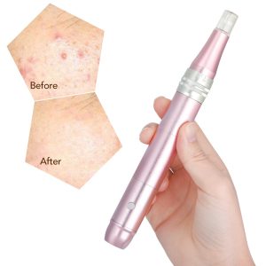 DP18-Electric-Micro-Needle-Skin-Therapy-Dermapen-Skin-Tightening-Remove-Scar-Reduce-Wrinkles-Tighten-Pores-Beauty-Device-01.jpg