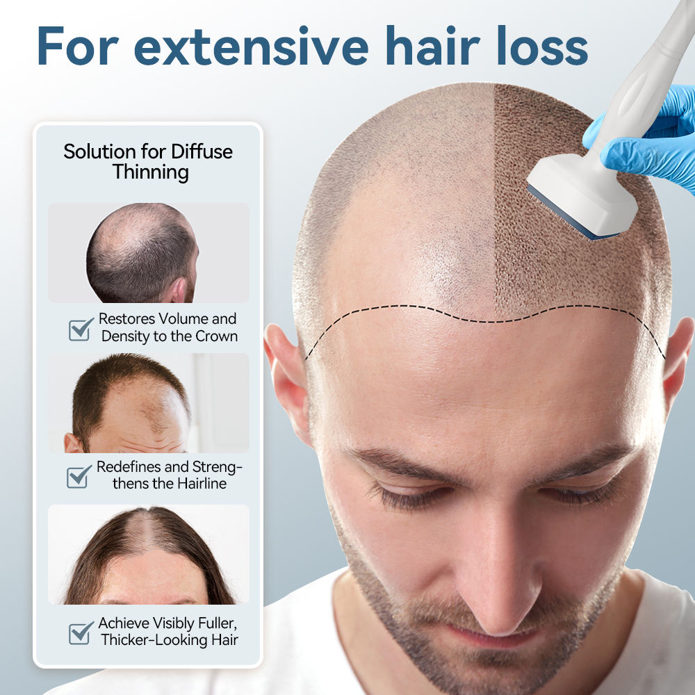 DRS140 Dermastamp 140 Pins Microneedle Stamp for Face, Scalp & Beard Growth 10 Pieces - Image 7