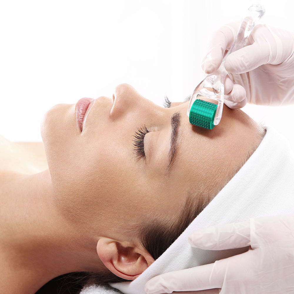 DRS192 Derma Roller - Professional Microneedling Roller for Skin Rejuvenation & Hair Growth 10 Pieces - Image 6